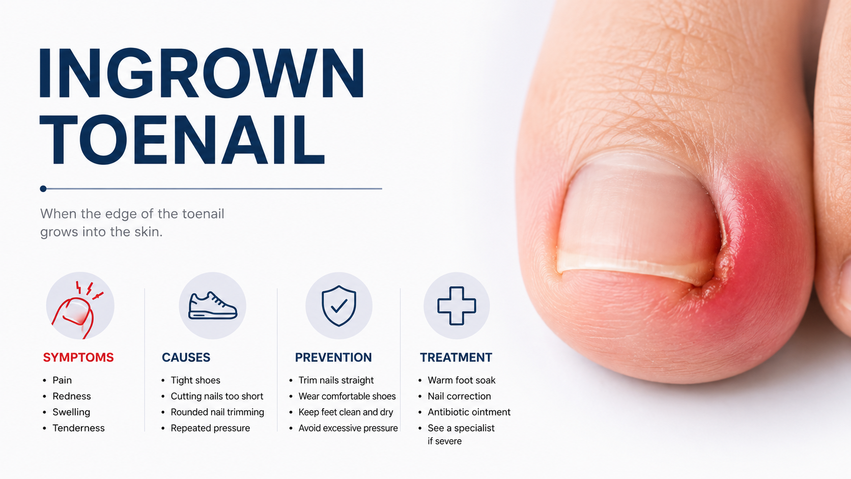 Ingrown Toenails: 7 Secrets to Stop Recurrence for Good